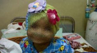 Pufelia Audriana Putri, balita penderita penyakit yang belum diketahui jenisnya - Foto: okezone.com