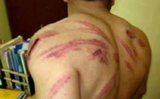 Salah satu penyiksaan fisik yang diterima aktivis anti kudeta (islammemo)