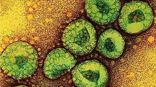 Partikel Virus MERS-CoV - (vijesti-x.com)