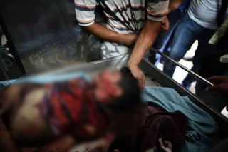 Ilustrasi - Bocah Palestina korban serangan Israel. (aqsatv.ps)