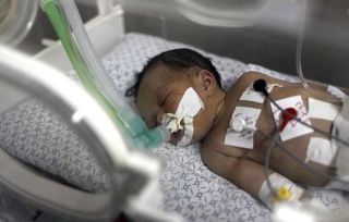 Bayi Shayma saat mendapat perawatan di Inkubator. (veooz.com)