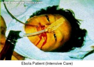 Virus-Ebola