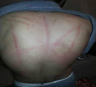 Bentuk penyiksaan yang dialami tahanan Mesir di dalam penjara  (islammemo.cc)