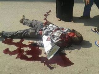 Salah seorang korban kekerasan dari aparat rezim kudeta Mesir. (Islammemo.cc)