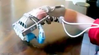 Seorang balita laki-laki terlahir tanpa tangan sehingga ia kini mengunakan tangan robotik yang dicetak dengan menggunakan printer 3D. (techradar.com)