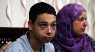 Anak Palestina korban penyiksaan Zionis Israel.  (knrp.org)