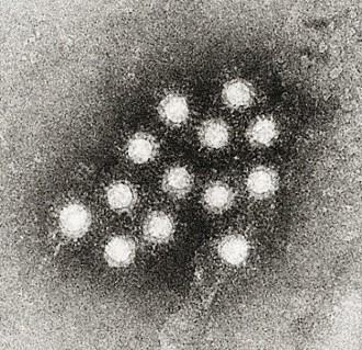 Virus Hepatitis-A (wikimedia.org)