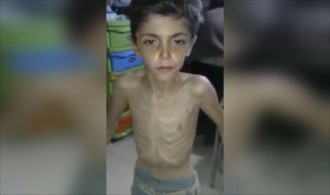 Kelaparan di Suriah (aljazeera.net)